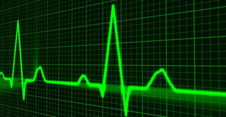 Stellar Price Analysis: XLM Can Test the $0.295 Level